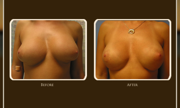 Before and After Photo